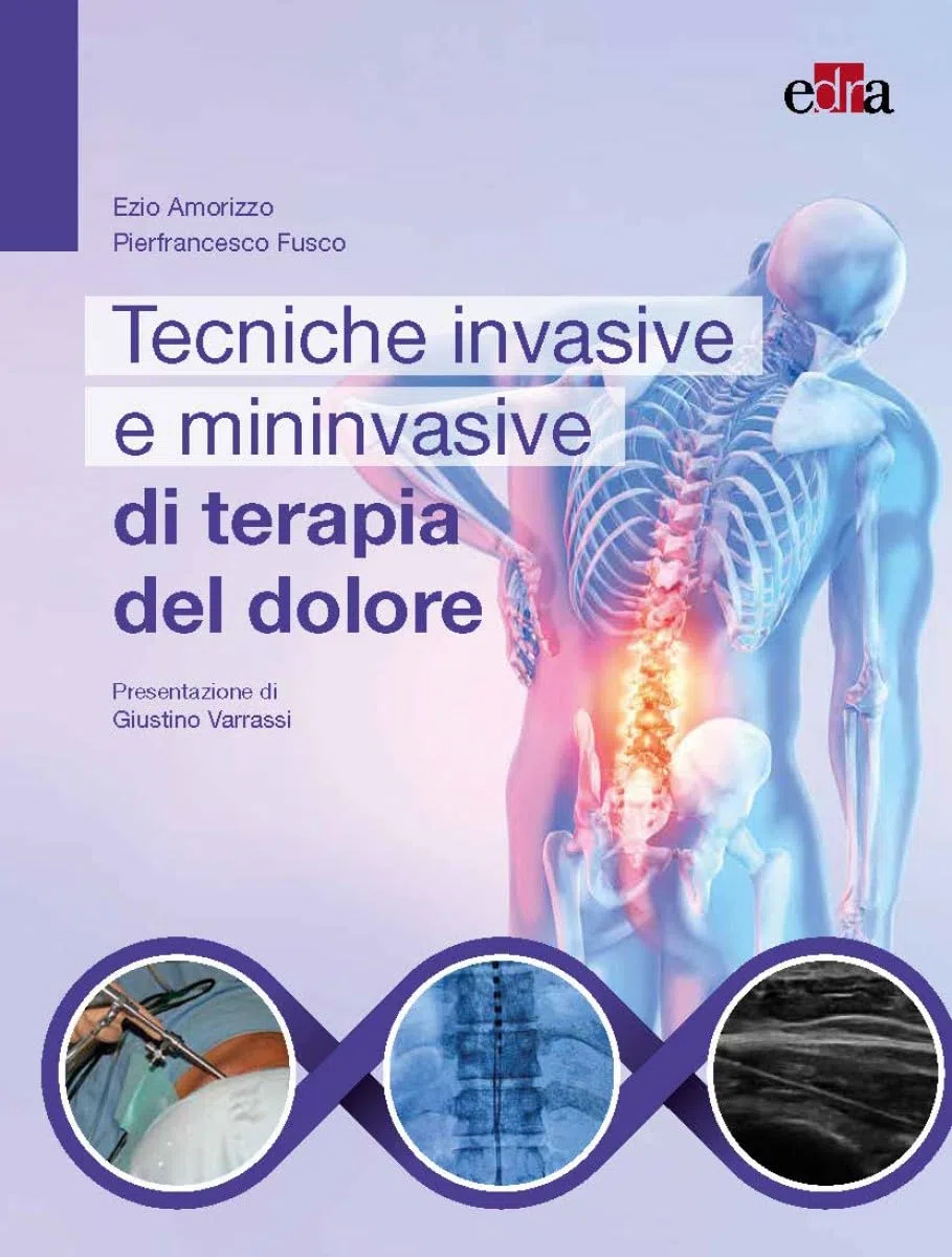 Tecniche invasive e mininvasive di terapia del dolore