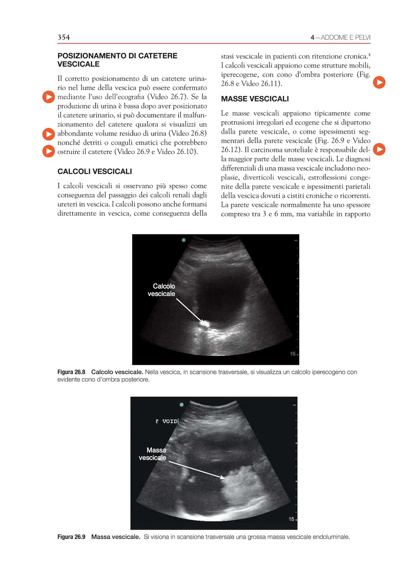 Ecografia. Point-of-care